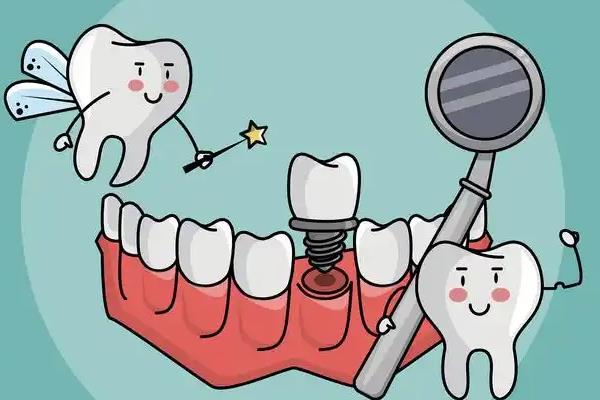 瑞士士卓曼种植牙好不好？种植牙质量好/使用寿命长/型号多样/价格不贵