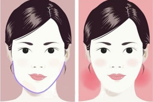 为什么医生不建议做正颌矫正手术？原因有三，来看正颌不后悔的成功经验