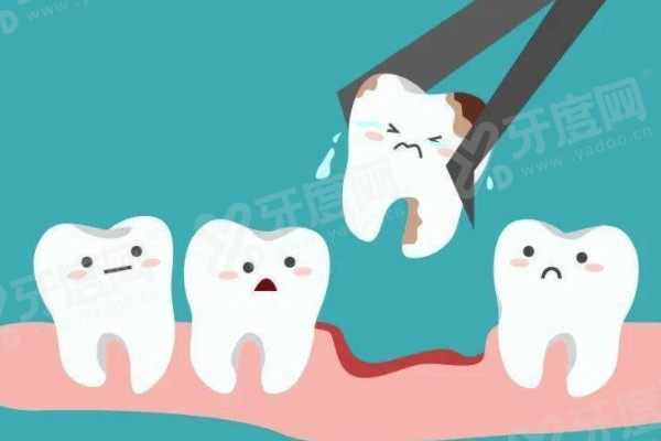 拔智齿能走医保报销吗？定点医院+治疗性质才可报，3天止痛+7天拆线/附医保报销条件