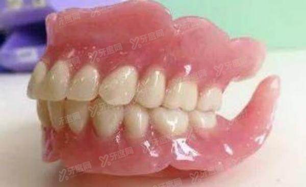什么叫无挂钩假牙？是一种不需要磨牙的吸附性义齿！
