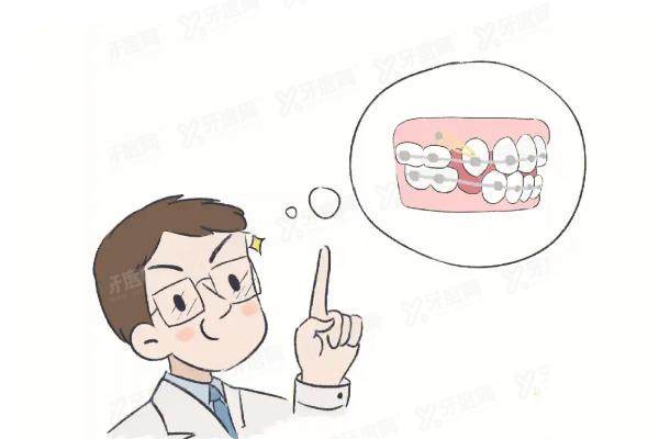 张栋梁正畸水平怎么样？正畸水平高口碑好-三大技术腻害，正畸费用2万起