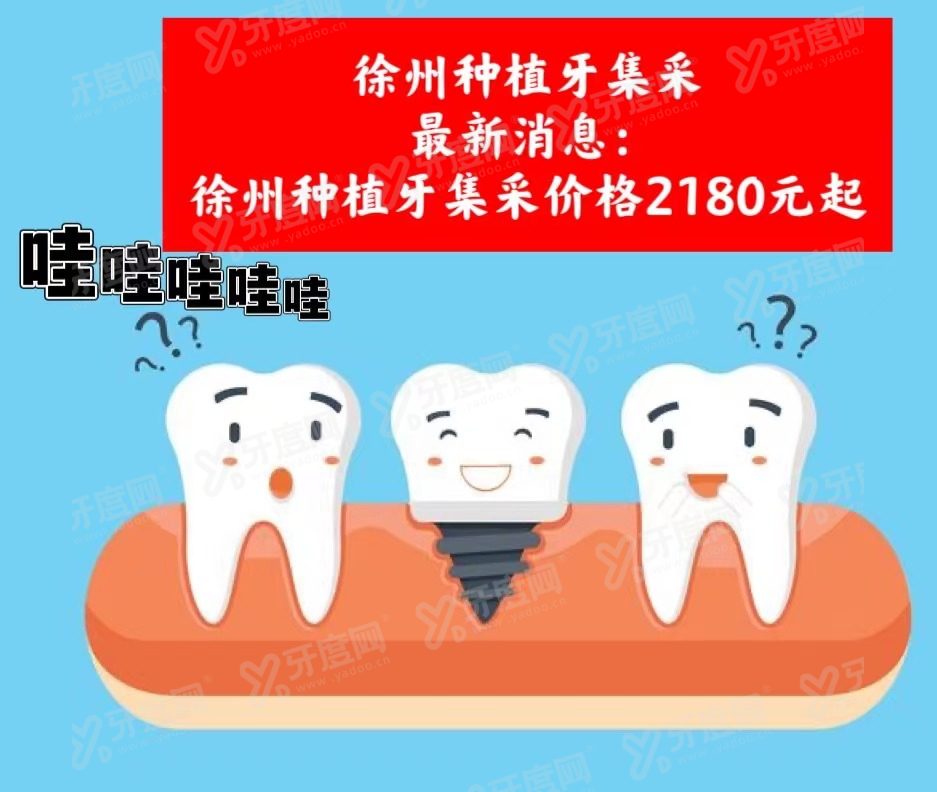 徐州种植牙集采最新消息：徐州种植牙集采价格2180元起|降幅55%