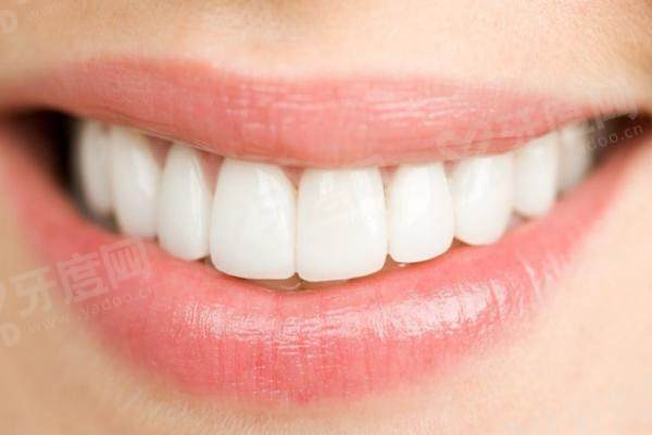 济南百年中牙口腔补牙多少钱？普通树脂 150 元起！进口树脂 380 元起，补牙效果自然逼真！