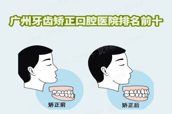 广州牙齿矫正口腔医院排名前十：含穗华|广大等高口碑医院矫正优势+价格介绍