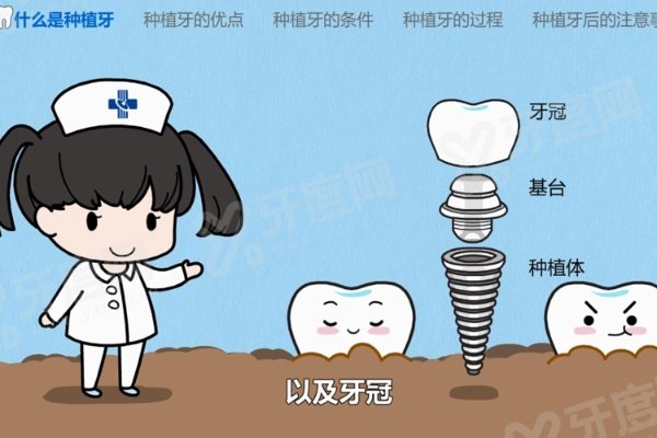 东营百年口腔医院种植牙价格揭秘:单颗1960+半口3万+全口5万+