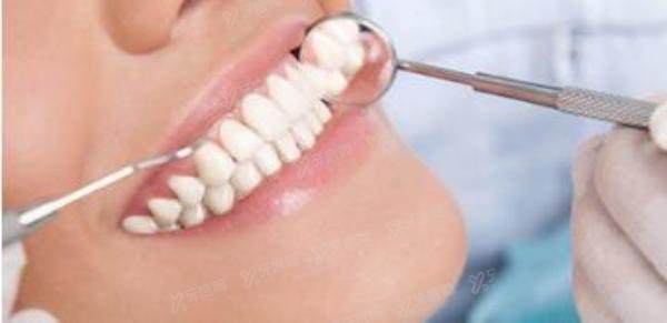 牙周治疗4000元贵不贵？牙周的治疗方法决定了牙周治疗费用