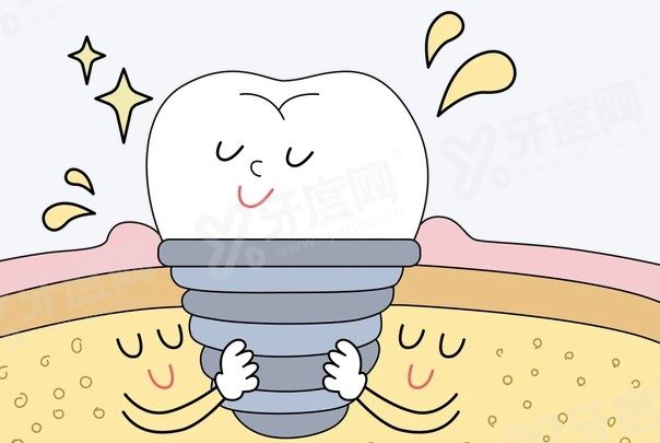 金华蓝芽口腔种牙多少一颗?2980元起韩系植体！张剑超医生坐诊