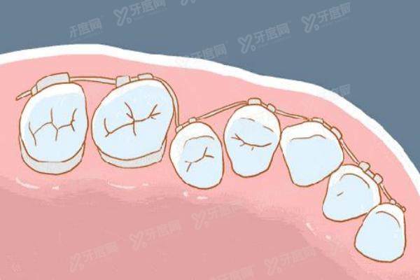 毕节牙齿矫正口腔医院排名前十：盛华口腔/大方牙管家口腔/牙友口腔排前三名