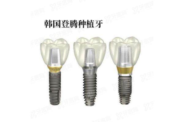 韩国登腾种植体是什么材质？是四级纯钛材质，登腾种植体寿命/价格/优缺点解析