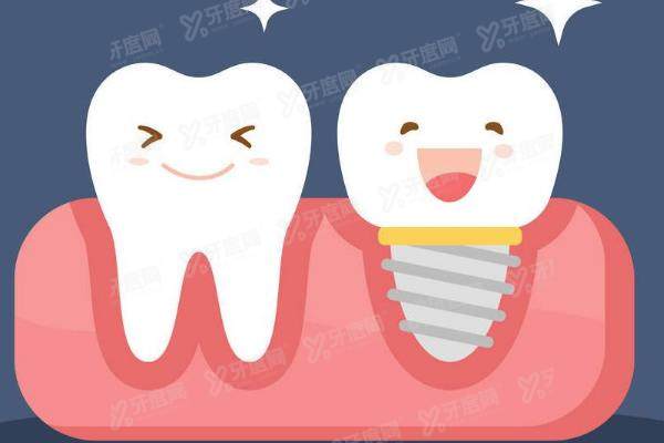 广州种植牙医生排名榜：杨子楠|陈卓凡|高岩等有名的种植牙医生均有上榜