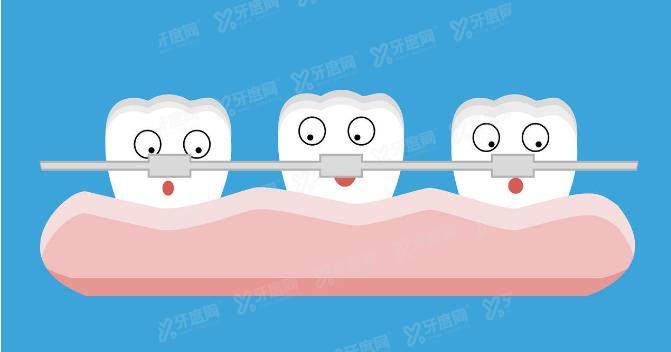 重庆南岸区牙齿矫正价格表：自锁8500起|陶瓷15250起|隐形17500起