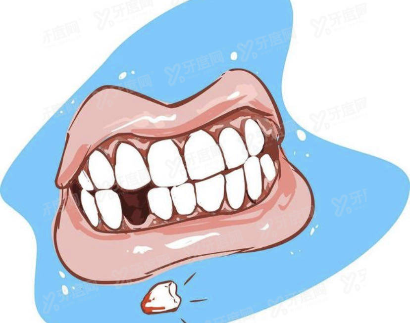 少了一颗牙齿怎么办,一定要补上吗?牙齿缺失的修复方式有....