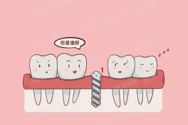 重庆九龙坡区种植牙口腔医院排名前十：团圆口腔/牙博士口腔/乐乐欣口腔排前三名