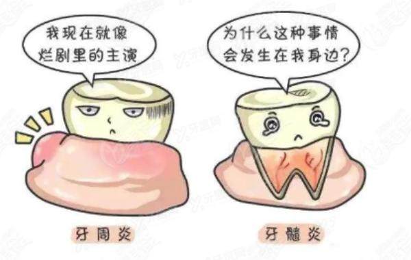 牙周炎和牙髓炎哪个更严重？牙周炎和牙髓炎的区别