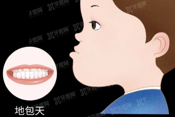 公布国内十大地包天矫正医院排行榜：广州|北京|上海|杭州均有上榜医院