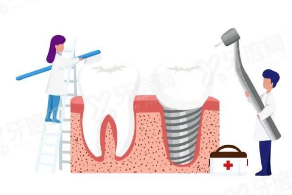 柳州口腔医院种植牙价格表：2990一颗/半口全口3.6w起|含排名前三医院名单