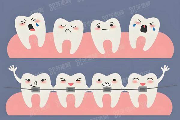 镶后槽牙三连问：选活牙还是死牙好？用什么材料好？从200-2万价格解析！