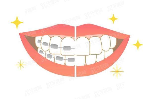 三亚牙齿矫正口腔医院排名前十：三亚口腔/微笑口腔/鼎点口腔排前三名