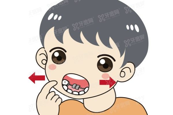 嘴突矫正后悔一辈子？亲身经历：嘴突矫正真的有用，不做更后悔！