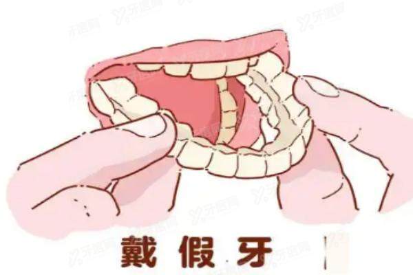 德国无挂钩精密假牙好不好？用户评价舒适度高且价格不贵1万元起！