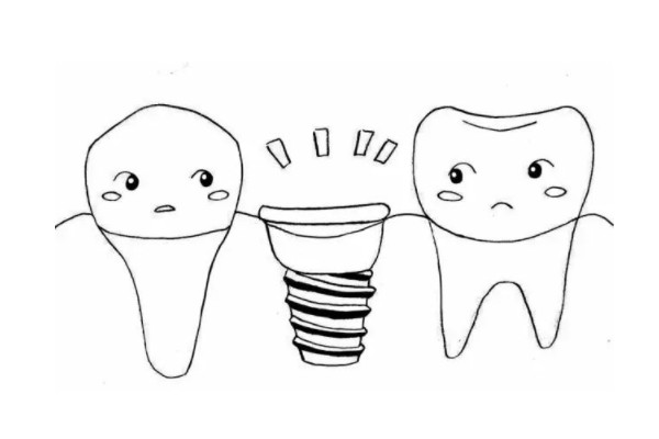 抚州口腔医院种植牙价格表：一颗3800元起/半口全口4.2w起