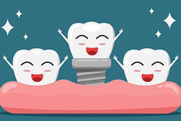 种植体选欧美的还是韩国的?来看两者技术|适用|维护|价格的区别