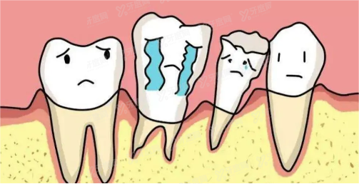 牙齿为什么会松动？揭晓牙齿松动的几种解决方法