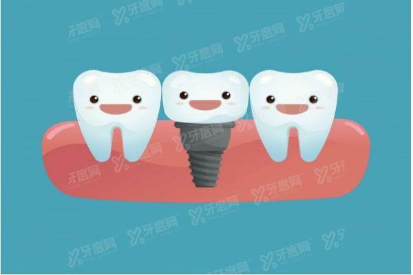 种植牙发炎了怎么处理？谈谈种植牙发炎原因、处理方法以及后续保养方法