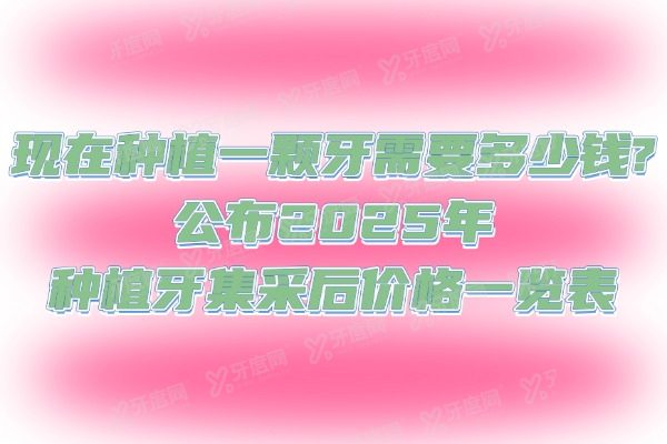 现在种植一颗牙需要多少钱?公布2025年种植牙集采后价格一览表
