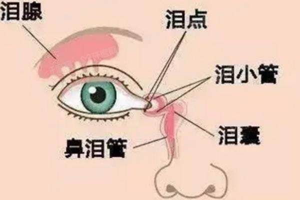 泪囊炎是什么症状？.jpg