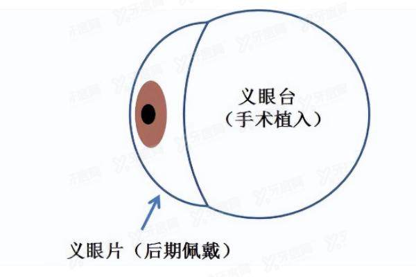 2024爱尔眼科义眼片价格yanke.yadoo.cn