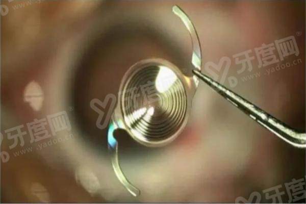 跃无极人工晶体的价格yanke.yadoo.cn 跃无极人工晶体的价格yanke.yadoo.cn