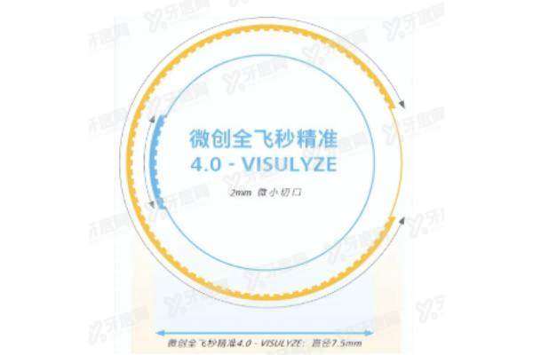 全飞秒4.0手术已经上市了yanke.yadoo.cn