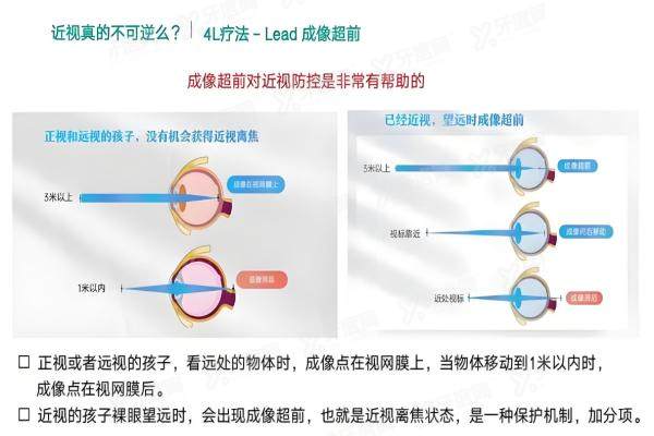 赵阳4L治疗近视可信吗？yk.yadoo.cn