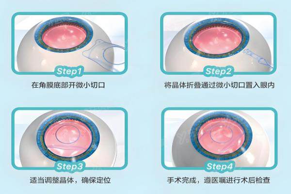 河北邢台眼科医院价格表查询yanke.yadoo.cn