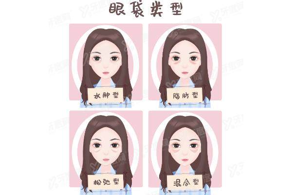 祛眼袋哪种方法比较好yimei.yadoo.cn