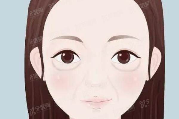 玻尿酸填充卧蚕yimei.yadoo.cn.jpg