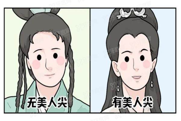 美人尖种植