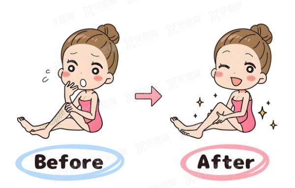 激光脱毛的副作用和危害