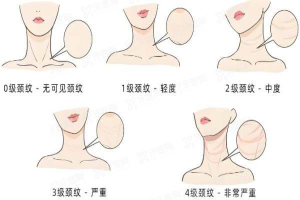 嗨体注射yimei.yadoo.cn