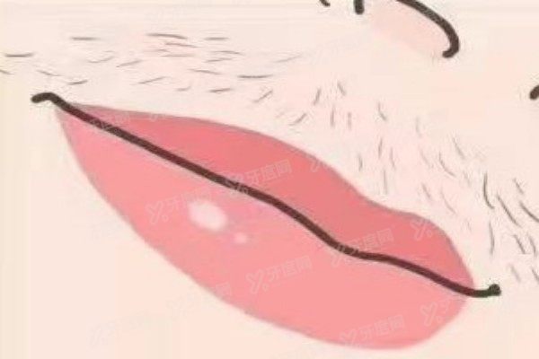 yimei.yadoo.cn脱唇毛.jpg