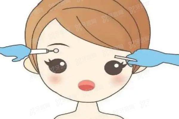 纹洗眉yimei.yadoo.cn.jpg