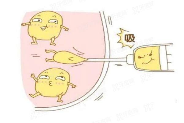 吸脂yimei.yadoo.cn