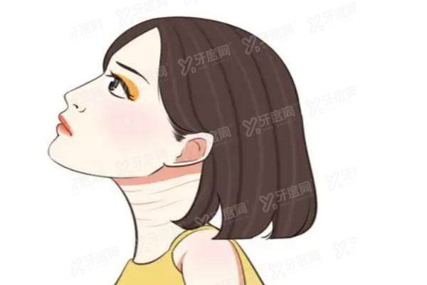 嗨体去颈纹yimei.yadoo.cn.jpg