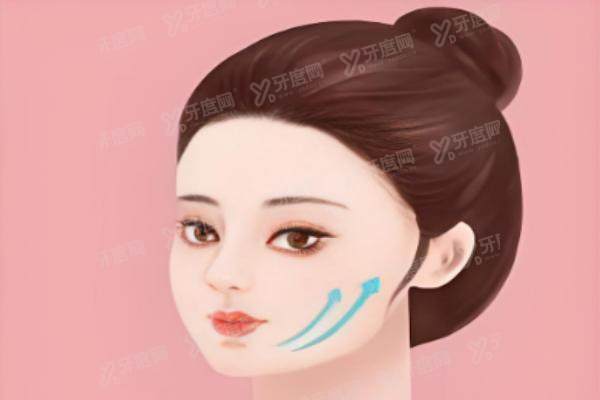 什么是埋线提升面部yimei.yadoo.cn.jpg