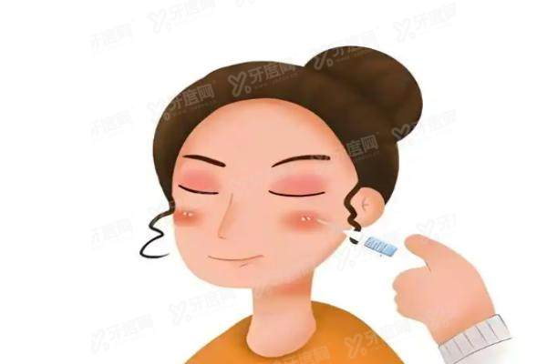 注射轮廓固定是什么意思？.jpg