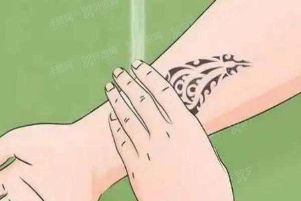 祛纹身会留疤吗yimei.yadoo.cn