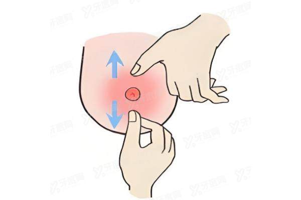 乳晕整形是什么？yimei.yadoo.cn.jpg