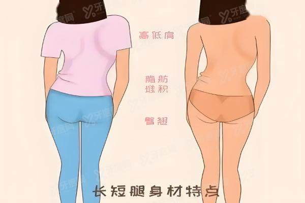 长短腿矫正yimei.yadoo.cn