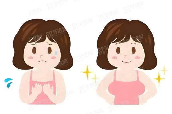 乳头整形影响哺乳吗？.jpg